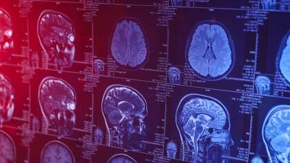 Los astrocitos están involucrados en la formación de la memoria