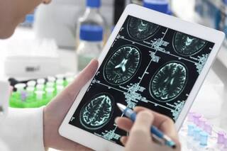 El coronavirus produce una reducción de materia gris en el cerebro: cuáles son las áreas más afectadas