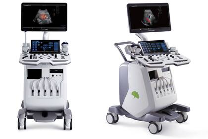 Los avances tecnológicos infieren positivamente en la salud (Ecógrafo Vinno G86. Gentileza CSH)