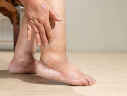 Los calambres nocturnos y el dolor al caminar son señales de alerta vascular.