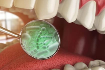 Los carbohidratos refinados se metabolizan rápidamente por bacterias cariogénicas y aumentan el riesgo de lesiones de caries, erosión y enfermedad periodontal