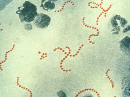 Los CDC describen al estreptococo A como una bacteria que puede causar distintos tipos de infecciones