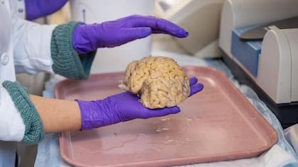 Los cerebros analizados habían sido donados a la ciencia para su análisis