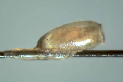 Los científicos encontraron ADN humano antiguo en el "cemento" que recubre a las liendres