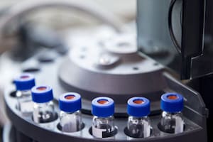 ¿Podría un análisis de sangre predecir si alguien tendrá Alzheimer? La respuesta de los expertos