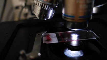 Los científicos vienen estudiando qué ocurre con las moléculas de contaminación que ingresan en nuestros cuerpos