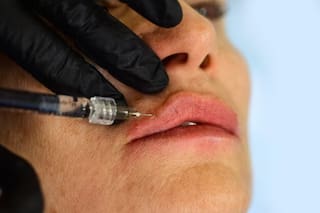 ¿Estás pensando en rellenarte los labios? Esto es lo que tenés que saber