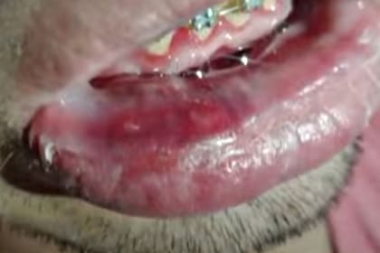 Los daños que recibió el joven golpeado en Villa Crespo