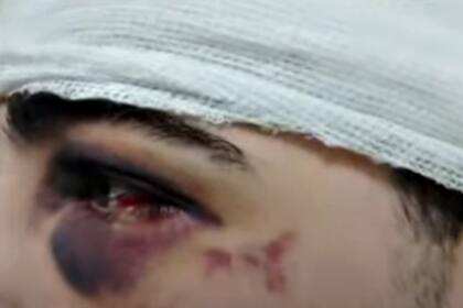 Los daños que recibió el joven golpeado en Villa Crespo
