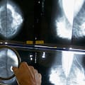 Ordenan notificar todos los casos de cáncer e insuficiencia renal crónica en el país