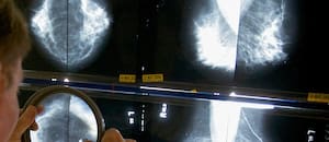 Ordenan notificar todos los casos de cáncer e insuficiencia renal crónica en el país