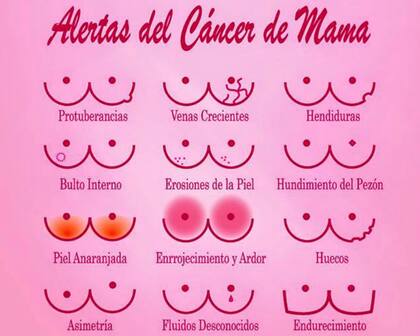 Los diferentes tipos de síntomas en cáncer de mama