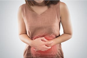 Los divertículos son pequeñas bolsas o sacos que se forman en la pared del intestino