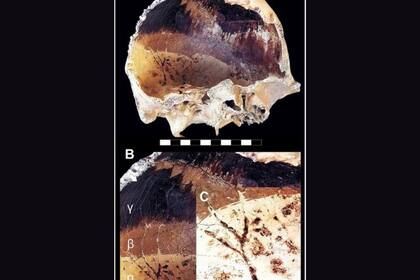Los efectos del calor en el cráneo de algunas de las víctimas