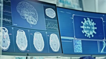 Los efectos post-covid en el cerebro incluyen cambios sensoriales, dolor de cabeza, fatiga y problemas de memoria