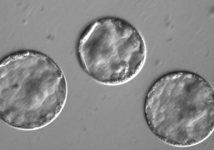  Hazaña: modifican genes en embriones humanos para evitar enfermedades