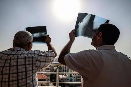 Los especialistas aconsejan no ver los eclipses con radiografías (Photo by MAHMUD HAMS / AFP)