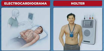 Los estudios más comunes cuando aparecen las palpitaciones