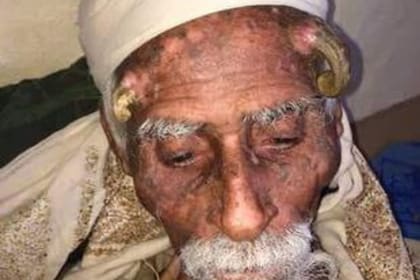 Los familiares del "hombre cabra" aseguran que tenía 140 años