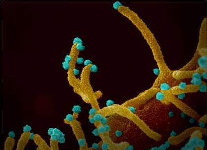 Los filopodios no son comunes pero se han visto en otros virus como el de Marburgo