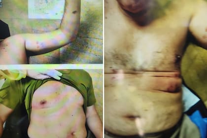 Los heridos tras la explosión