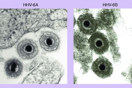 Los herpesvirus humanos como el HHV-6A y el HHV-6B generan muchas preguntas a día de hoy en los científicos