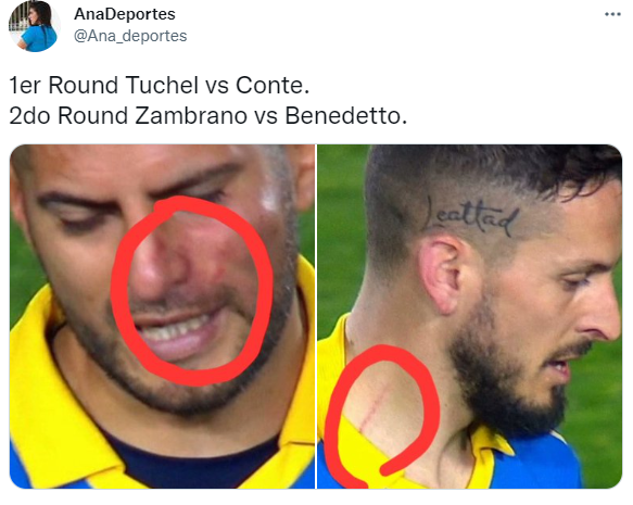 Los hinchas de Boca también recordaron la pelea entre Thomas Tuchel y Antonio Conte