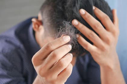 Los hombres también son afectados por la caída de cabello, hasta incluso a una temprana edad