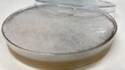 Los hongos mucormicetos pueden crecer rápidamente