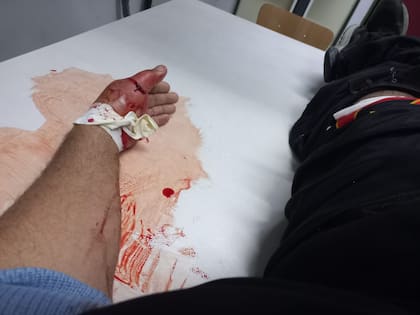 Los impactos de bala le causaron daños en su mano izquierda, en el muslo izquierdo y además sufrió otro roce de bala en la pierna derecha.