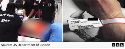 Los intentos de reanimar a Epstein