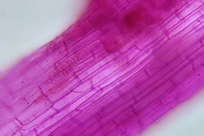 Los investigadores del Inta, Conicet y la Universidad del Nordeste detectaron el virus RMV que afecta al arroz