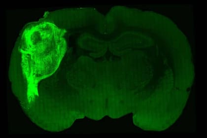 Los investigadores han trasplantado un organoide de cerebro humano (verde brillante) en el cerebro de una cría de rata recién nacida, creando un cerebro híbrido en el que las neuronas interactúan