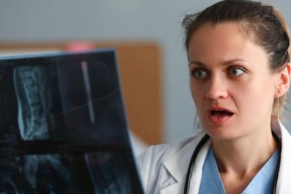 Los médicos frecuentemente se topan con objetos extraños dentro del cuerpo de los pacientes