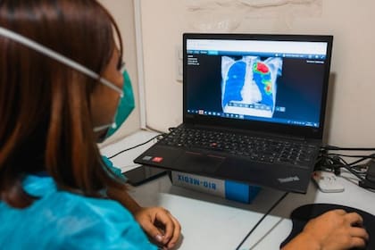 Los médicos y técnicos de TB Móvil usan un software de lectura automatizada basada en inteligencia artificial que lee la radiografía