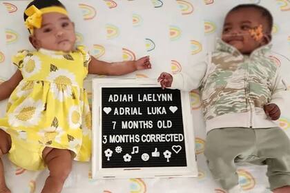 Los mellizos todavía van a revisiones médicas, pero están en buen estado de salud