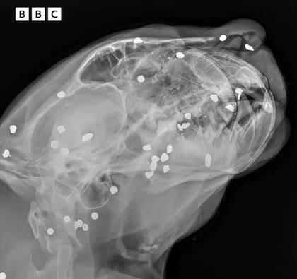 Los perdigones de la escopeta habían lesionado varias partes de su cabeza (Captura: BBC)