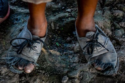 Los pies de un chico wichi de la comunidad de Tres Pozos