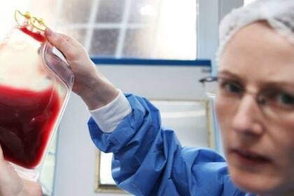 Los portadores de sangre Rh nulo pueden padecer anemia leve