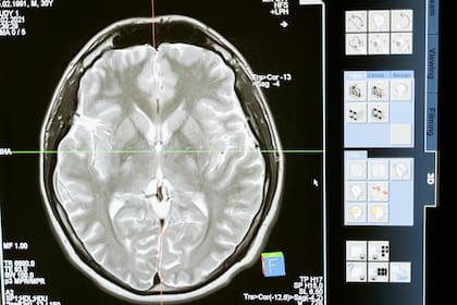 Los problemas con el sueño pueden acelerar la pérdida de la memoria (imagen ilustrativa)