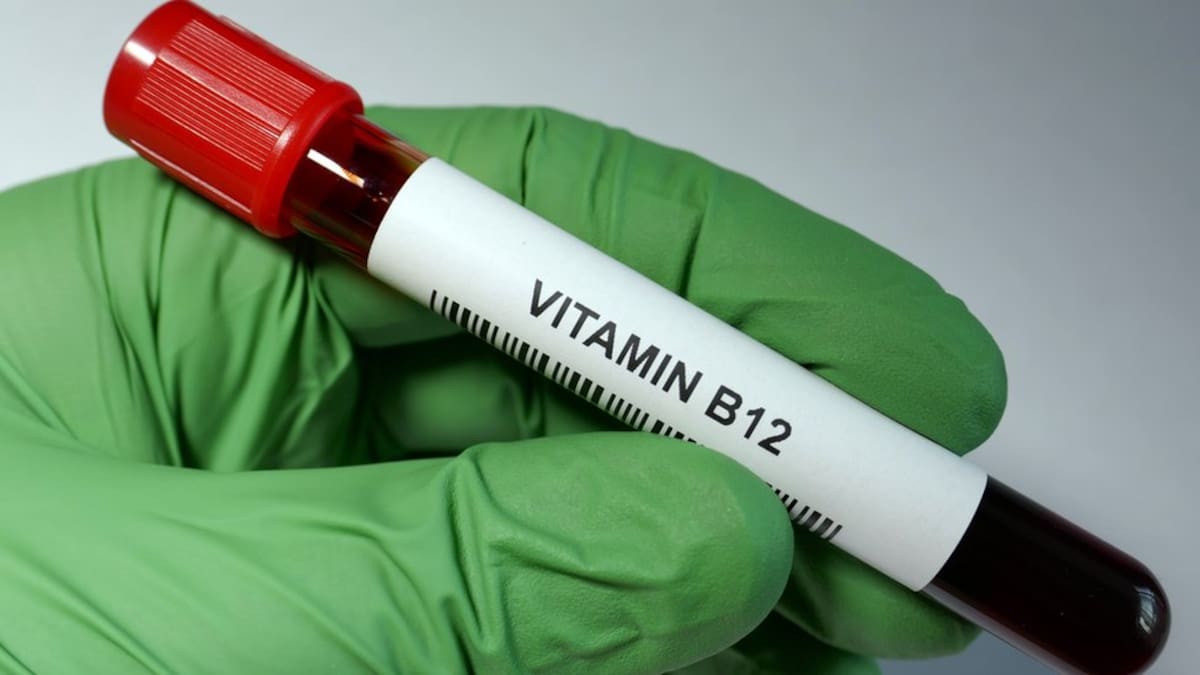 Vitamina B12: ¿Cuál es su papel clave en la salud del corazón?