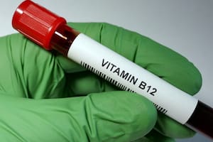 Los problemas de visión están relacionados a la falta de vitamina B12.