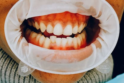 Los profesionales señalan la importancia de hacer un contros antes de someterse a un tratamiento (Foto Pexels)