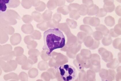 Los protagonistas de la respuesta inmunitaria adaptativa son los linfocitos, capaces de generar anticuerpos y memoria inmunológica