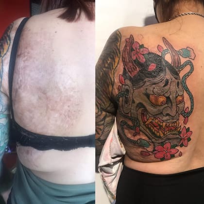 “Los que se quemaron vuelven a brillar. Vivieron toda su vida de noche, sin veranos. Vivían tapados, camuflados por vergüenza. Hoy, ellos no se ven quemados", explica Diego Staropoli