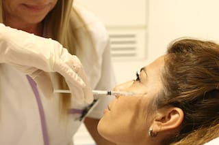 Rellenos faciales: se practican 26 millones por año, pero pueden no ser inocuos