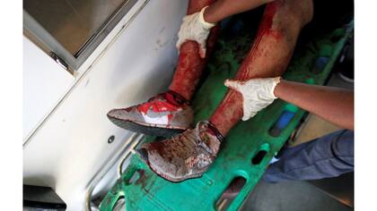 Los rescatistas de Comandos de Salvamento asisten a un presunto miembro de una pandilla después de haber sido disparado