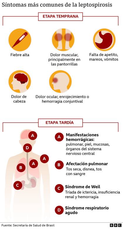 Los síntomas de la leptospirosis