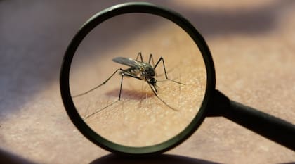 Los síntomas más comunes de la fiebre perezosa incluyen fiebre alta, dolor de cabeza intenso, escalofríos, dolores musculares y articulares, náuseas, vómitos y sarpullido (Universidad de Cien fuegos)