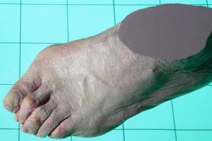 Los usuarios de esos zapatos seductores sufrieron por su moda.